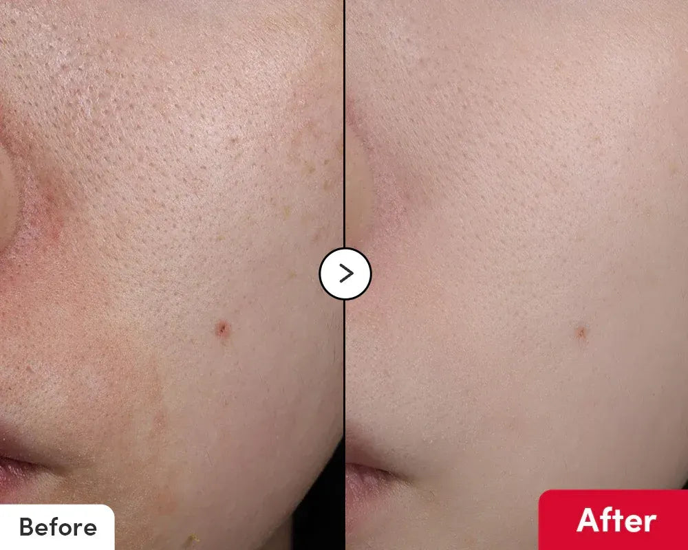 EQQUALBERRY Vitamin Illuminating Serum 30ml