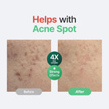 PURITO SEOUL Wonder Releaf Centella Serum Unscented 60ml