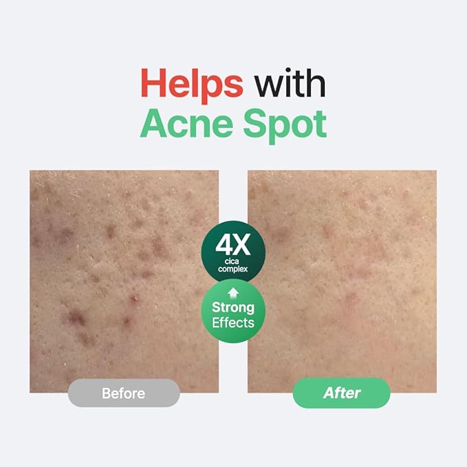 PURITO SEOUL Wonder Releaf Centella Serum Unscented 60ml