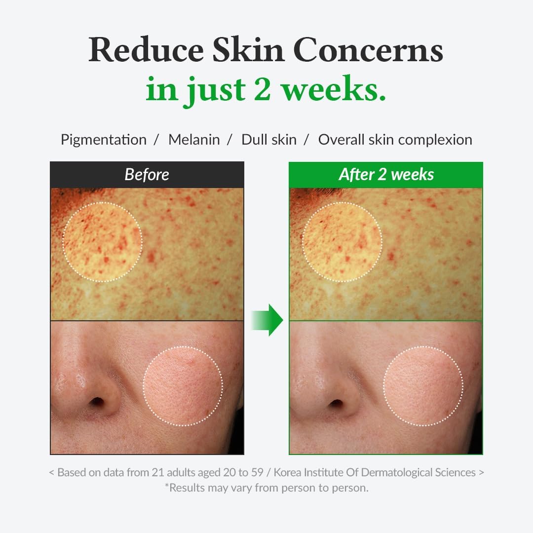 DR. ALTHEA Gentle Vitamin C Serum