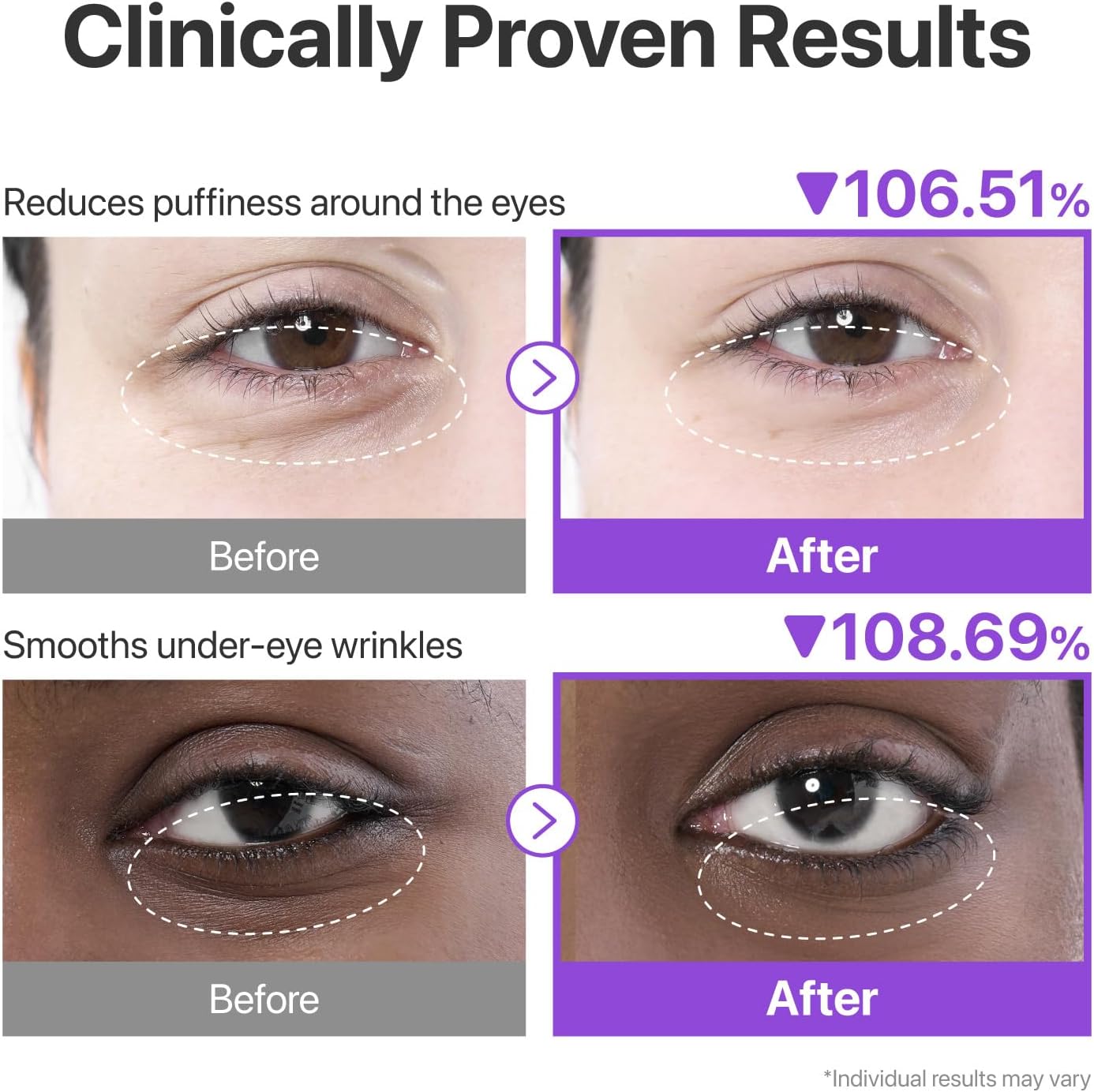 NUMBUZIN NAD+collagen under eye patches