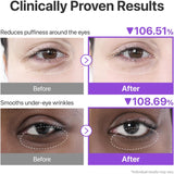 NUMBUZIN NAD+collagen under eye patches